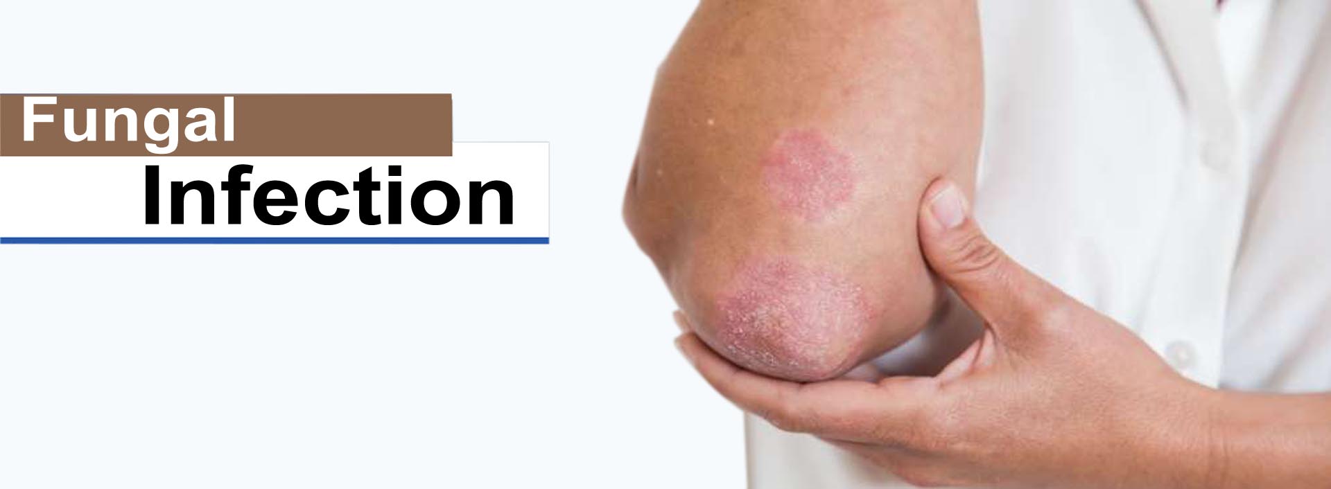 Fungal Infection Treatment in Gurgaon